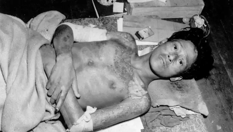 80 Yıl Sonra Nagasaki'den Gelen Uyarı: Nükleer Tehditler Artıyor!