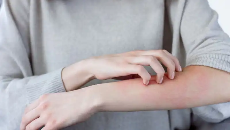 Cilt Kanserinin Göz Ardı Edilen Belirtileri: Dermatolog Açıklıyor!
