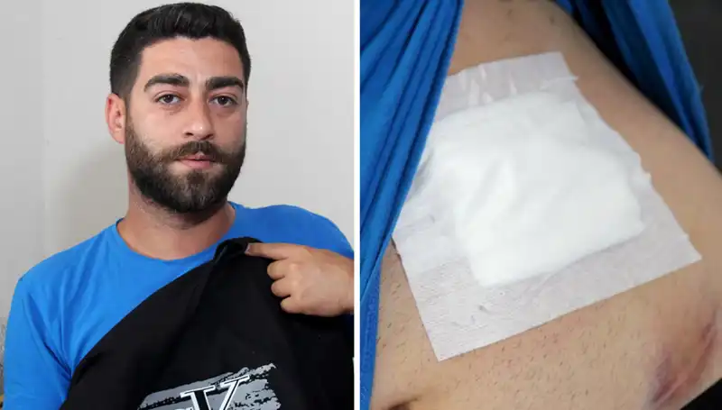 Karnındaki Ağrıya Dikkat! Röntgen Sonrası Şok Edici Gerçek Ortaya Çıktı